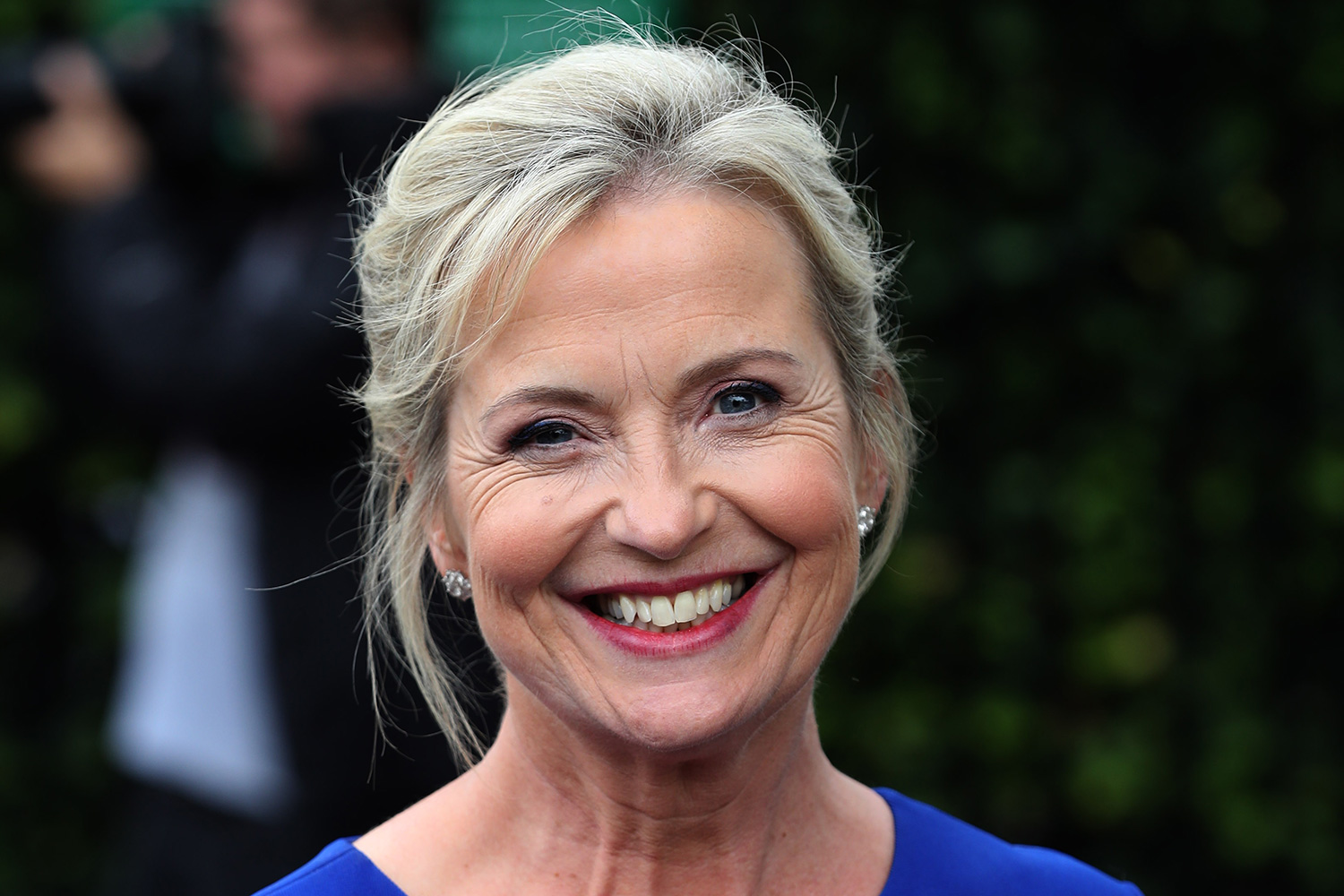 Did Carol Kirkwood Get Plastic Surgery Body Measurements And More Plastic Surgery Stars 9697