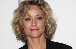 Teri Polo Cosmetic Surgery