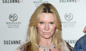 Jackie Siegel Plastic Surgery Procedures