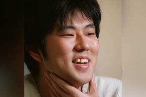 Eiichiro Oda Plastic Surgery and Body Measurements