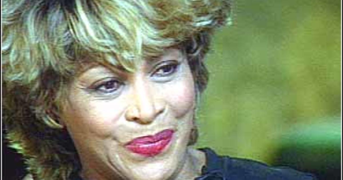 Tina Turner Nose Job