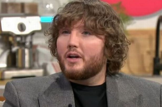 James Arthur's Transformation: Nose Job, Veneers, and Plastic Surgery ...